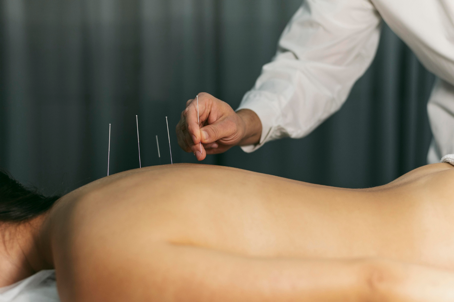 Exista efecte adverse la tratament cu acupunctura?