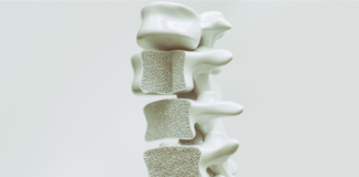 Osteoporoza și spondiloza cervicală: afecțiuni cu impact semnificativ asupra sănătății și calității vieții