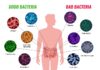 Clostridium difficile