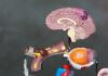 RMN cerebral: când este recomandat și ce rol are în diagnosticarea afecțiunilor neurologice