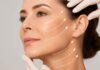 Ce rezultate poate oferi un lifting facial și cât timp se mențin