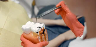 Cand sunt necesare tratamentele stomatologice de canal?