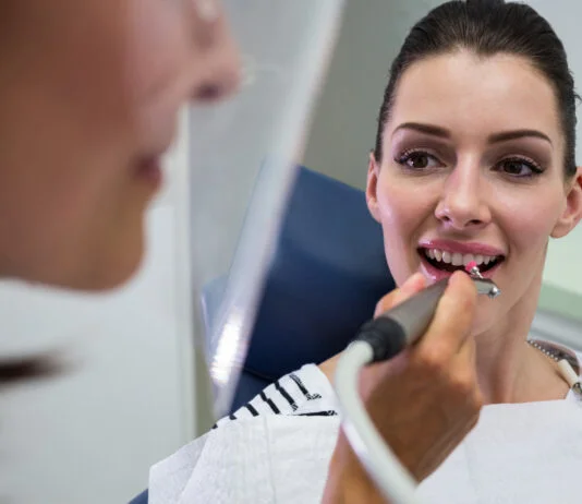 Cat de des trebuie sa mergem la medicul stomatolog pentru efectuarea detartrajului dentar?